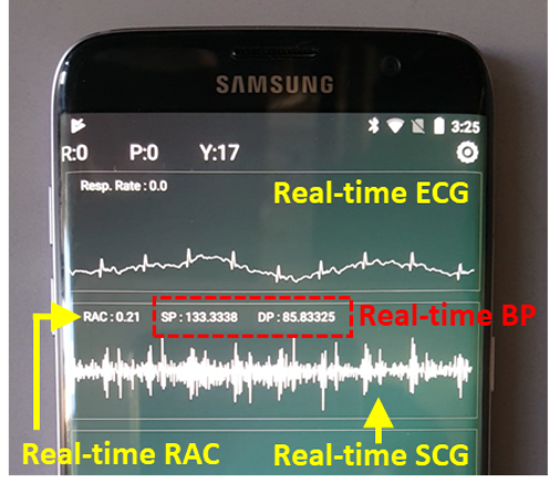 recording of data from trial