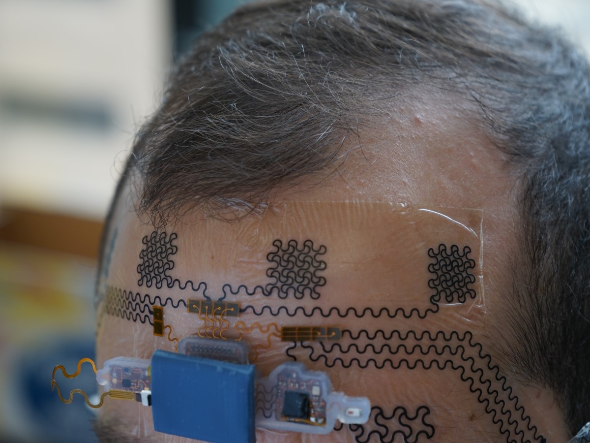 e-tattoo created by Texas Engineers Nanshu Lu and Luis Sentis applied to the forehead of a test subject