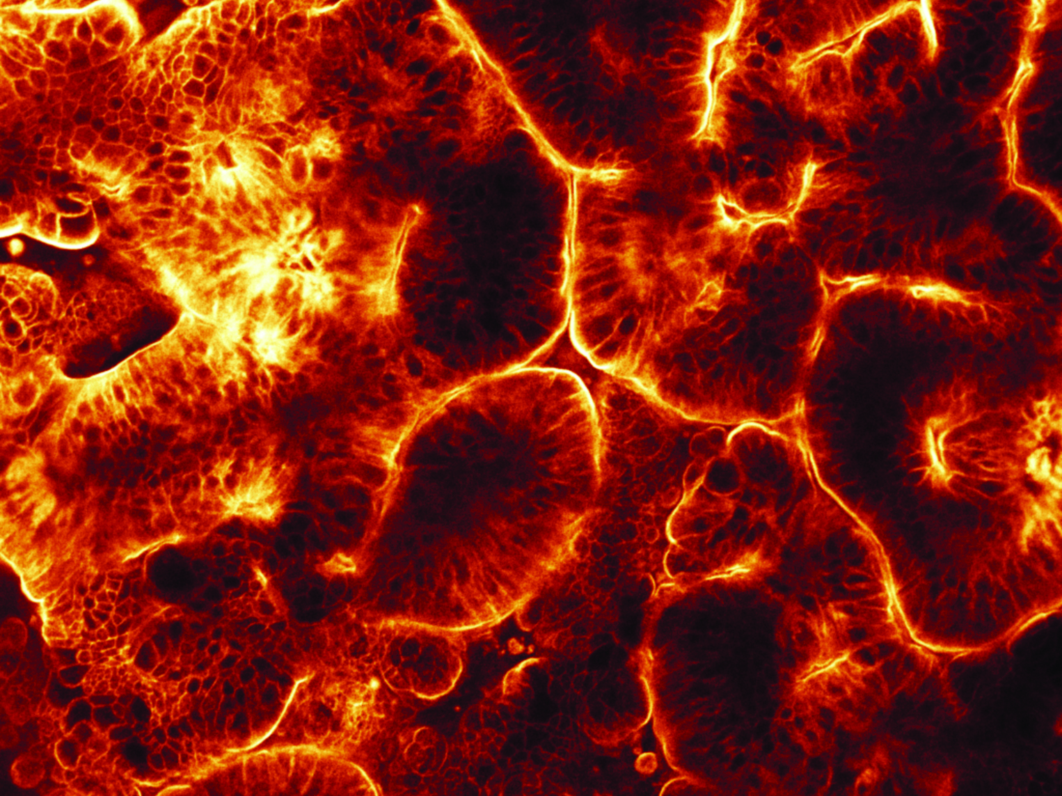 top-view of a 3D intestinal epithelium formed in a gut-on-a-chip