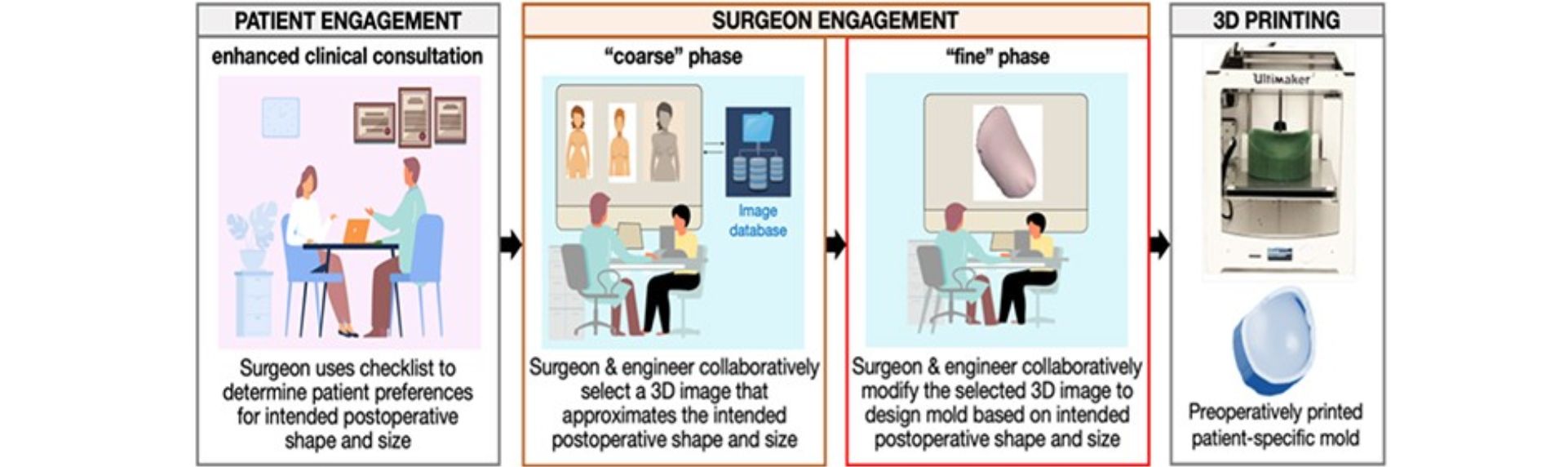 breast surgery process wide