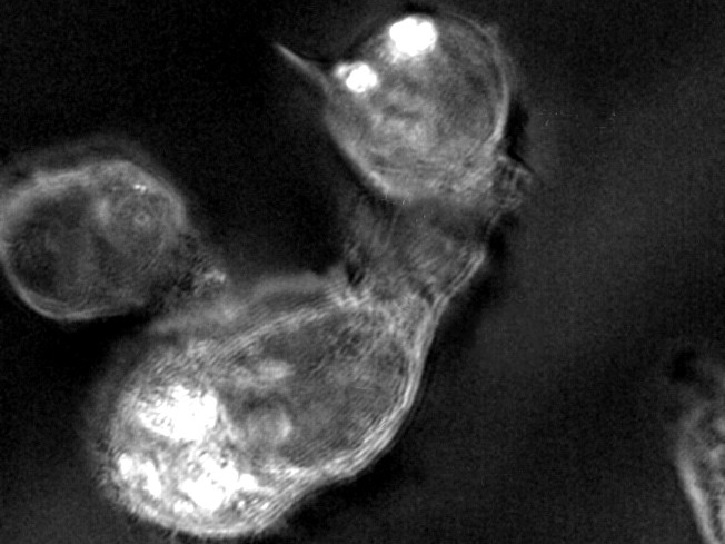 milner microscope tcell attacking tumor cell