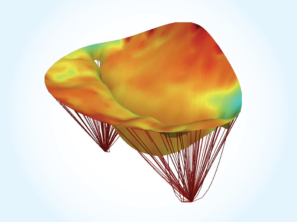 computational model of the heart mitral valve presurgery