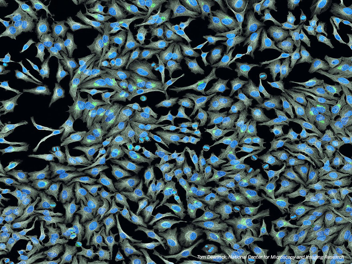 HeLa cells