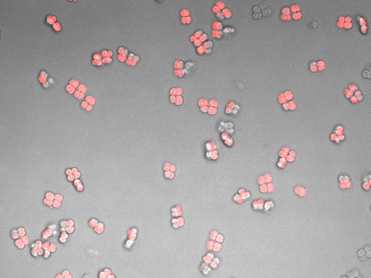 The bacteria Deinococcus radiodurans that Texas Engineer Lydia Contreras worked on as part of the Xenotext synthetic biotechnology project.