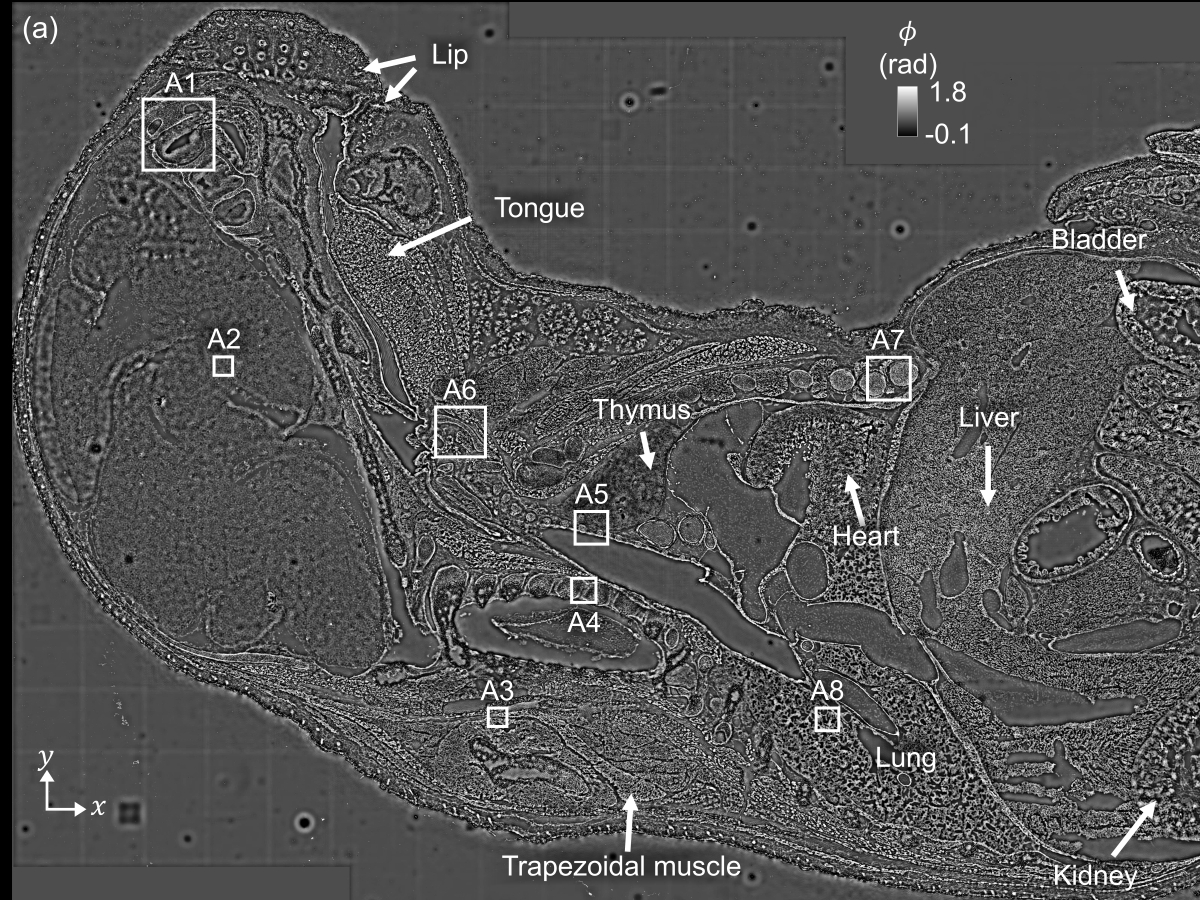 A microscopic image of a mouse embryo, developed by Texas Engineer Shwetadwip Chowdhury