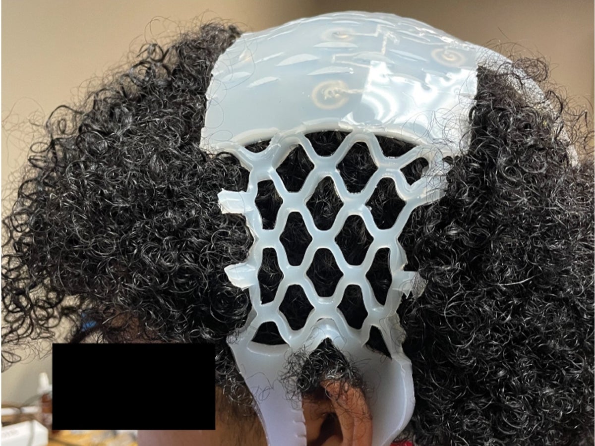 An EEG device on a patient with curly hair.